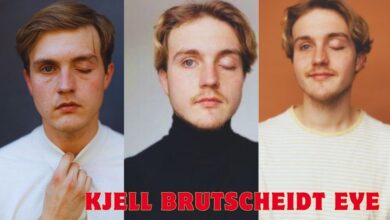 Kjell Brutscheidt's Eye