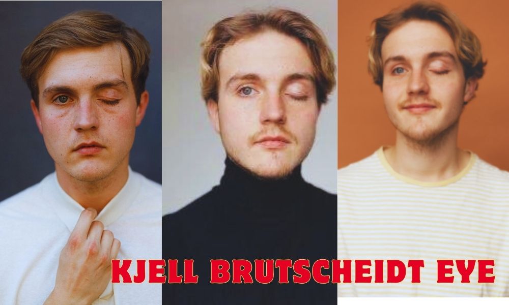 Kjell Brutscheidt's Eye